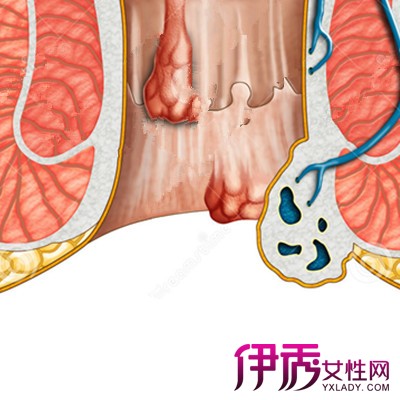 【图】痔疮栓使用方法图解大全 其使用方法及临床表现的推荐