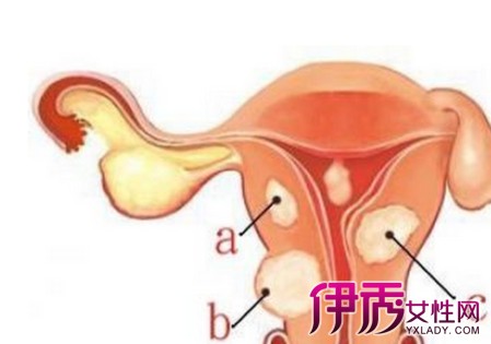 【图】讲解月经不来是什么原因 月经不来常规治疗方法介绍