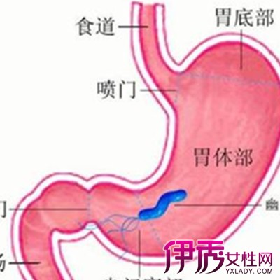 【图】胃病有哪些症状 盘点其三大并发症