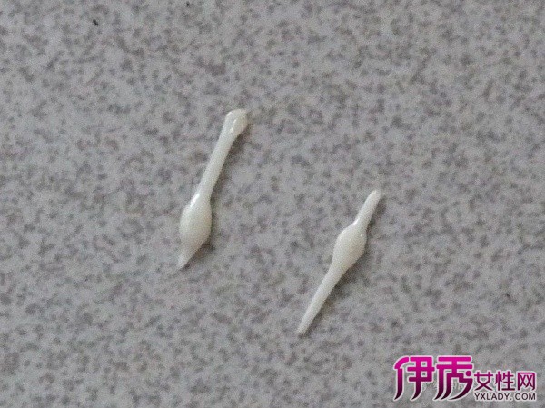 成人肚子里有虫的症状 小编告诉你有虫的症状以及建议