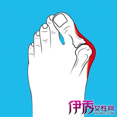 【图】脚大拇指关节痛是怎么回事呢 4种病的起因大盘点
