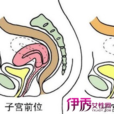 出血】【图】功能失调性子宫出血症状严重吗 