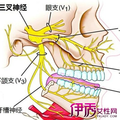 该病的特点是:在头面部三叉神经分布区域内,发病骤发,骤停,闪电样,刀