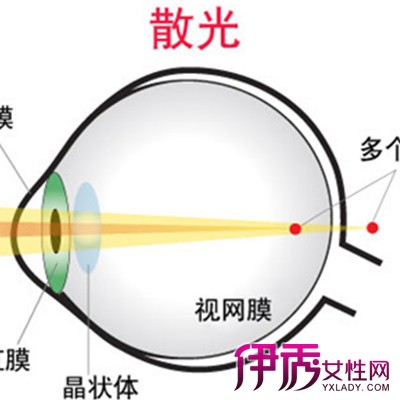 眼睛散光是怎么回事?