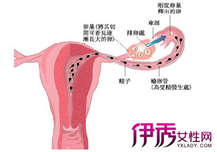 【输卵管通水后出血正常吗】【图】输卵管通水