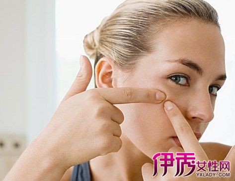 【粉刺治疗最好方法】【图】粉刺治疗最好方法