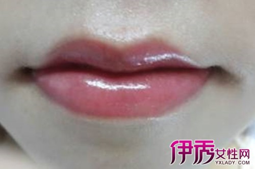 【嘴唇红润是表示健康吗】【图】嘴唇红润是表
