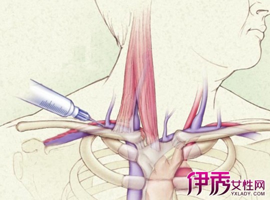 【图】锁骨下静脉解剖图片大全 带你了解锁骨下的静脉分布