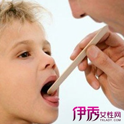 【图】扁桃体最佳治疗方法该如何预防