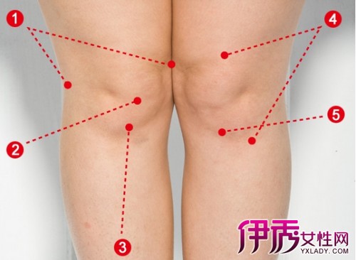 【图】摔了一跤膝盖肿了怎么办 专家解读怎样有效消肿