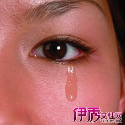 【眼睛被太阳晒伤怎么办】【图】眼睛被太阳晒