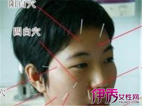 【左脸抽搐怎么办】【图】左脸抽搐怎么办 具