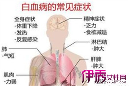 急性白血病如何治疗