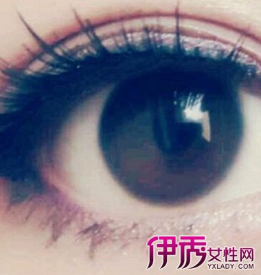 【眼睛好痒怎么办】【图】眼睛好痒怎么办 如