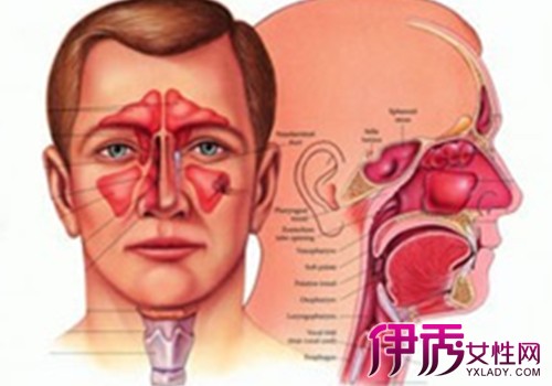 【图】鼻窦炎的症状及治疗方法有哪些 专家教你如何预防与护理