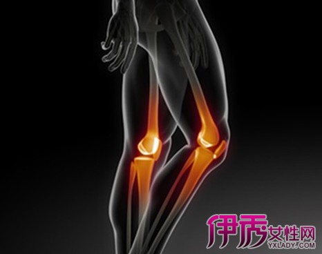【膝盖骨折属于几级伤残】【图】膝盖骨折属于