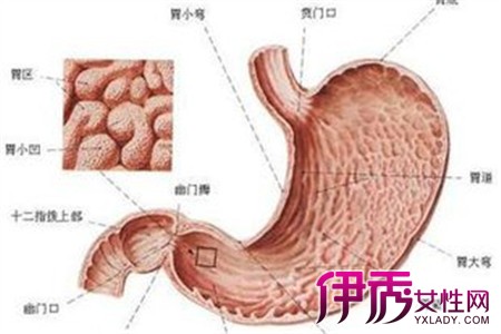【浅表性胃窦炎伴疣状改变】【图】浅表性胃窦