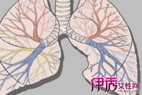 【支气管扩张咯血原因】【图】支气管扩张咯血