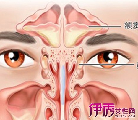 慢性上颌窦炎的的饮食护理word免费下载