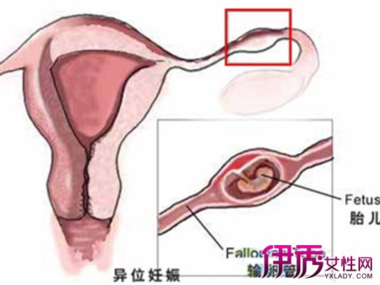 【月经前期有褐色分泌物】【图】月经前期有褐