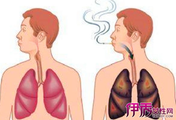 【吸肺病是什么症状】【图】吸肺病是什么症状