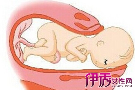 【胎盘附着于子宫前壁是什么意思】【图】胎盘