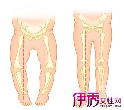 16个月腿弯曲正常图片图片
