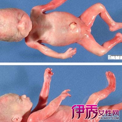 孕四个月胎儿真实图片图片