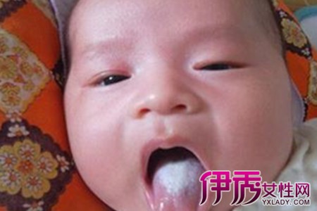 【图】婴儿舌苔厚白怎么去掉呢 妙招教你去除