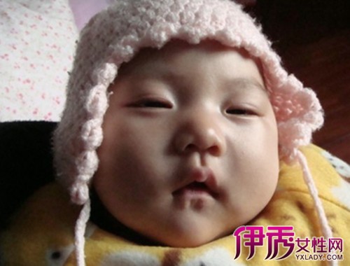 【图】新生儿双眼皮变化图 揭秘宝宝单双眼皮