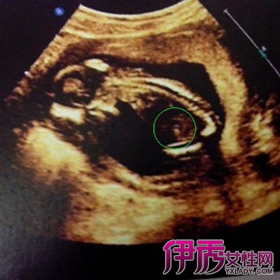 4个月胎儿图片 男孩图片