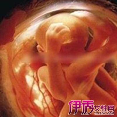 【图】怀孕三十六周胎儿图片展示 孕妈三大注