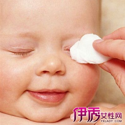 【图】宝宝脸上过敏图片大全 三种过敏原因提