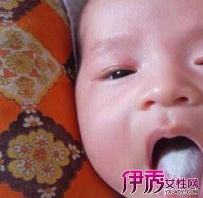 【图】婴儿舌苔发白是什么原因 教你从舌头看