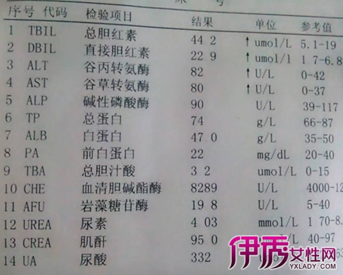 肝炎病毒dna参考值图片