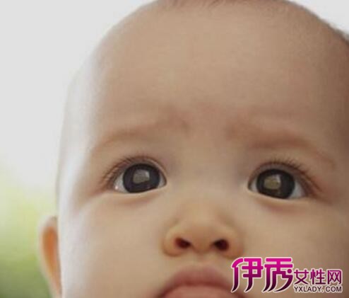 【图】四岁宝宝突然眼睛红有眼屎的原因6个原