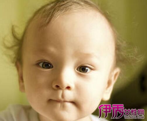 【图】一岁宝宝头发黄怎么办如何护理婴儿的头