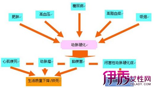 动脉硬化形成的原因图片