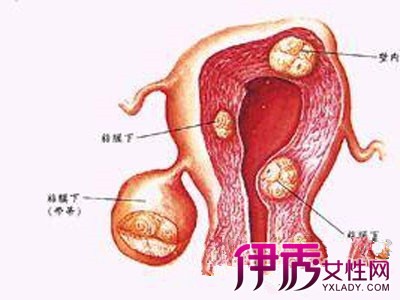 【图】子宫为什么会不规则出血 小编告诉你出血的原因