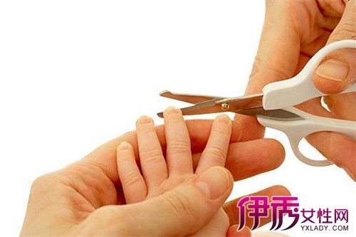 【图】剪指甲正确方法 注意指甲的日常护理