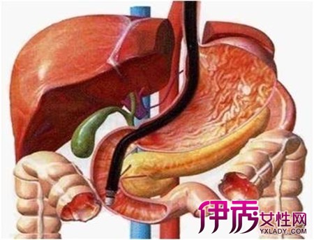 【圖】胰腺炎的症狀及治療有哪些? 4種症狀和治療方法介紹給大家