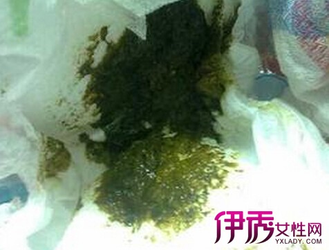 鸽子拉绿色大便图片