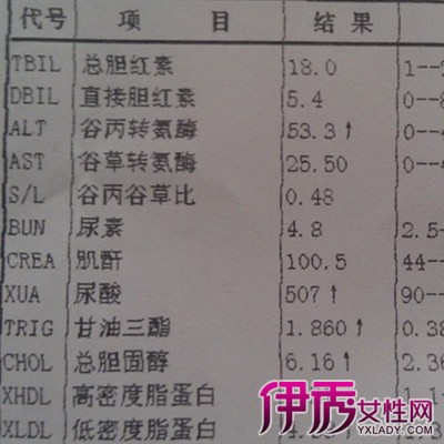 肌酐高是什么原因图片