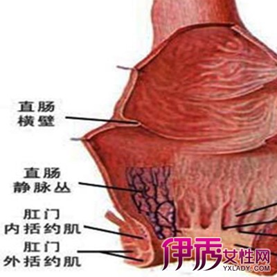 女性肛管癌的症状图片