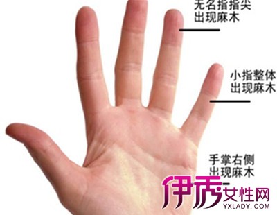 【图】引起左手麻痛是什么原因 秘引起手指麻痛的六大原因
