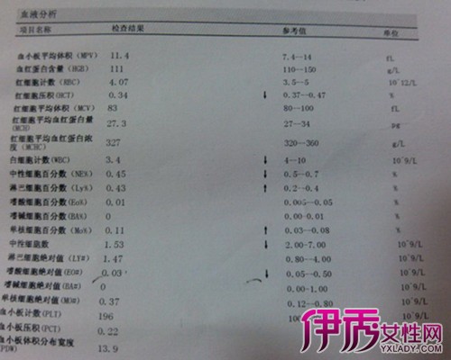 【图】血常规艾滋病能检查吗 如何检查和预防小技巧