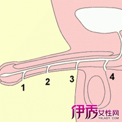 堵尿道的七种方法图片