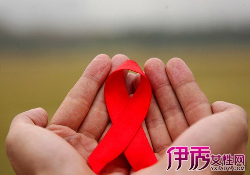 【艾滋病的血常规特点】【图】艾滋病的血常规
