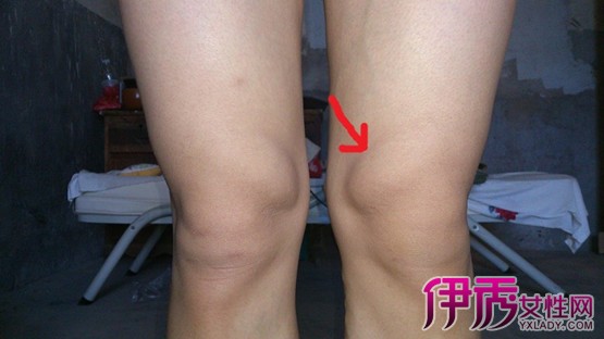 膝盖内侧疼是怎么回事呢 5大膝盖疼常见原因大盘点
