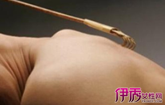 教你识别疥疮的最初症状图片 带你认知疥疮的